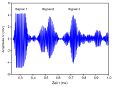 Vorschaubild der Version vom 15. August 2017, 13:23 Uhr